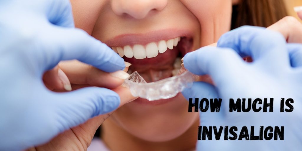 How Much Is Invisalign